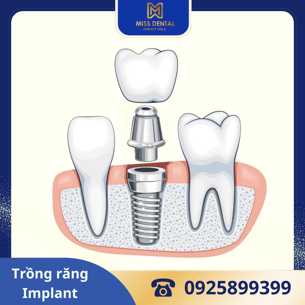 missdental.com.vn